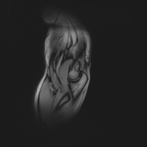 Click on the Serie image to view the images of Wieszt, Gnter